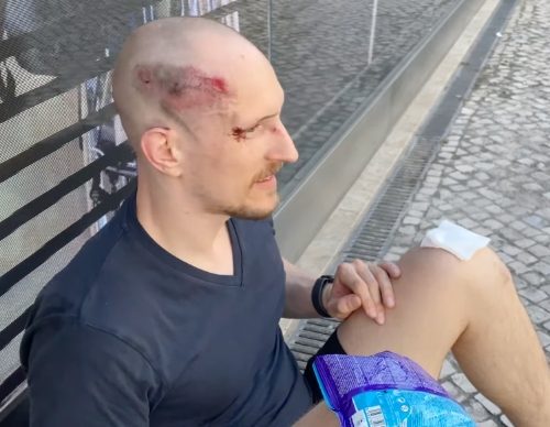 badly hurt after an accident, at what was already a low point in my life...